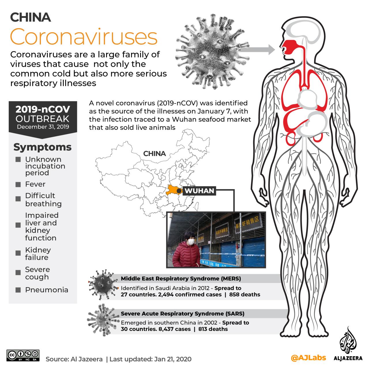 What is HMVP virus, Chinas recent 'Covid-like outbreak', should